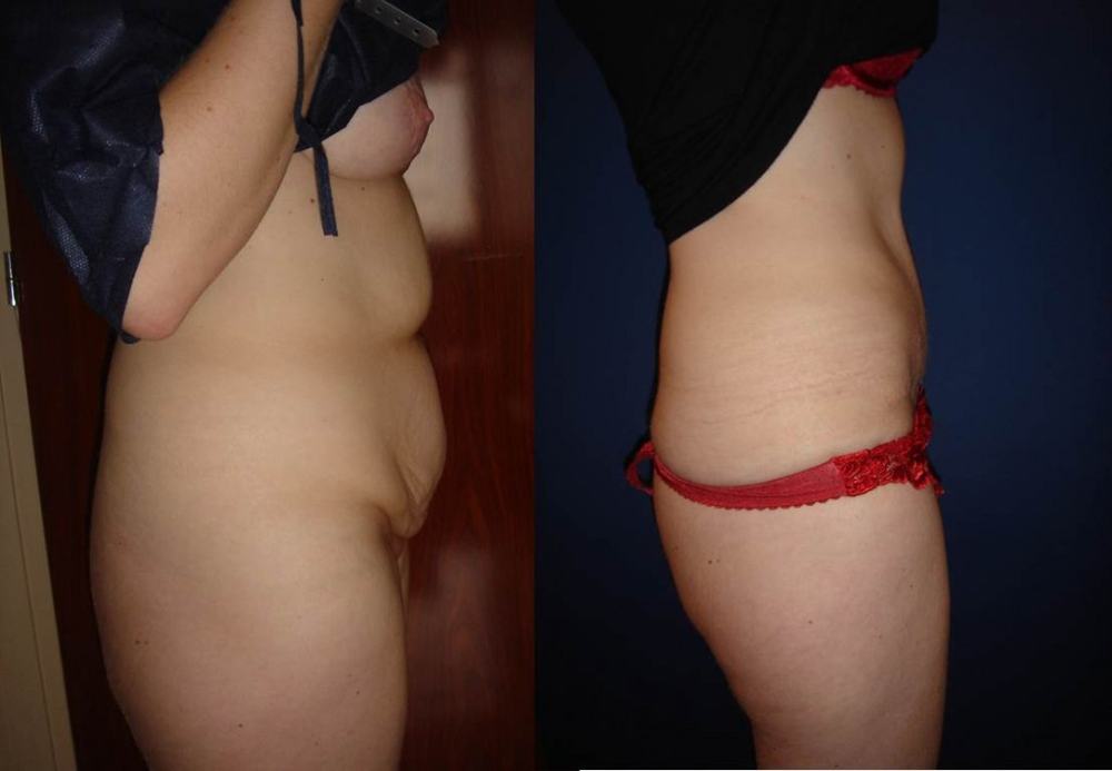 Photo Article Platysma 1 web