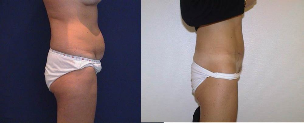 Photo Article Platysma 3 web