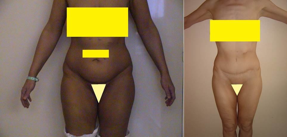 Photo Article Platysma 4 web